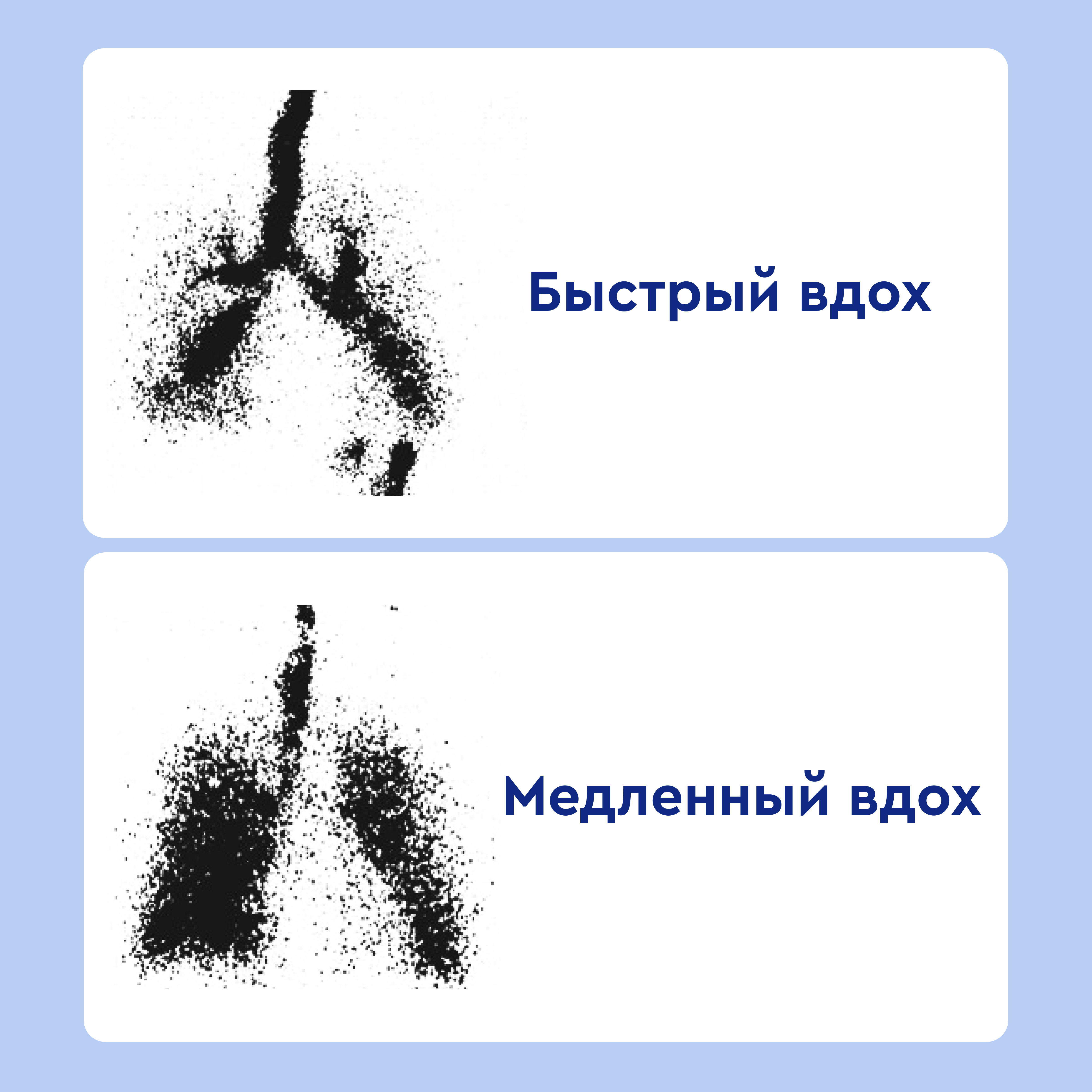 Небулайзер PARI LC SPRINT BABY размер 0  от интернет-магазина trimm.store